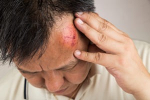 Riverside, MD Slip and Fall Accident Lawyer